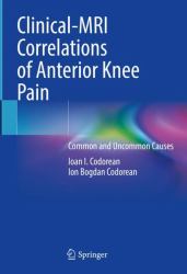 Clinical-MRI Correlations of Anterior Knee Pain : Common and Uncommon Causes