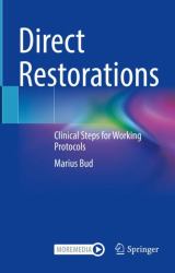 Direct Restorations : Clinical Steps for Working Protocols