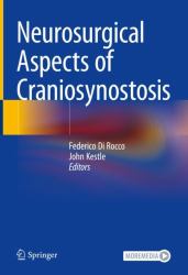 Neurosurgical Aspects Of Craniosynostosis