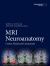 MRI Neuroanatomy : Cortex, Nuclei and Connections