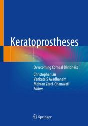 Keratoprostheses : Overcoming Corneal Blindness