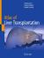Atlas of Liver Transplantation