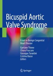 Bicuspid Aortic Valve Syndrome : A Not So Benign Congenital Heart Disease