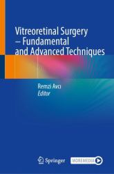 Vitreoretinal Surgery - Fundamental and Advanced Techniques