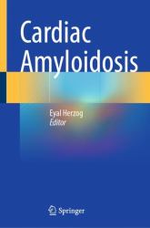 Cardiac Amyloidosis