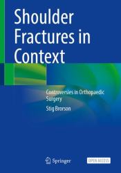 Shoulder Fractures in Context : Controversies in Orthopaedic Surgery