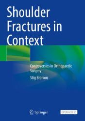 Shoulder Fractures in Context : Controversies in Orthopaedic Surgery