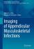 Imaging of Appendicular Musculoskeletal Infections