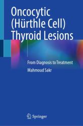 Oncocytic (Hürthle Cell) Thyroid Lesions : From Diagnosis to Treatment