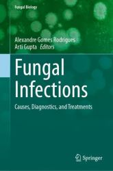 Fungal Infections : Causes, Diagnostics, and Treatments