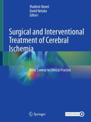Surgical and Interventional Treatment of Cerebral Ischemia : Basic Science to Clinical Practice