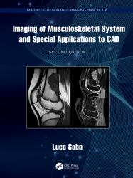 Imaging of Musculoskeletal System and Special Applications to CAD