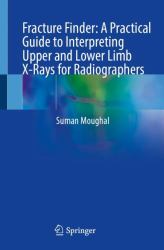 Fracture Finder : A Practical Guide to Interpreting Upper and Lower Limb X-Rays for Radiographers
