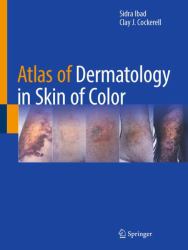 Atlas of Dermatology in Skin of Color