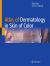 Atlas of Dermatology in Skin of Color