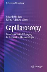 Capillaroscopy : Case-Based Nailfold Imaging for the Modern Rheumatologist