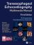 Transesophageal Echocardiography Multimedia Manual : A Perioperative Transdisciplinary Approach