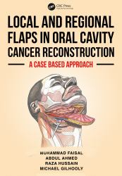 Local and Regional Flaps in Oral Cavity Cancer Reconstruction : A Case-Based Approach