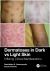 Dermatoses in Dark vs Light Skin : Differing Clinical Manifestations