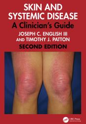 Skin and Systemic Disease : A Clinician's Guide