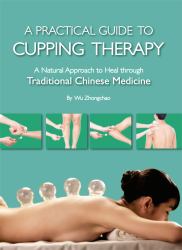 A Practical Guide to Cupping Therapy