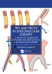 Tips and Tricks in Endovascular Surgery : A How to Guide for Reaching the Next Level in Endovascular Surgery