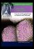 Colon Cancer : Current and Emerging Trends in Detection and Treatment