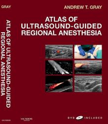 Atlas of Ultrasound-Guided Regional Anesthesia