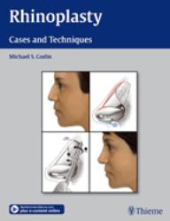 Rhinoplasty : Cases and Techniques
