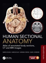 Human Sectional Anatomy : Atlas of Annotated Body Sections, CT and MRI Images