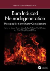 Burn-Induced Neurodegeneration : Therapies for Neuromotor Complications
