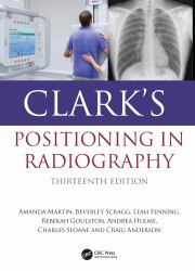Clark's Positioning in Radiography