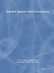 High-Risk Digestive Tumor Consultations