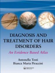 Diagnosis and Treatment of Hair Disorders : An Evidence-Based Atlas