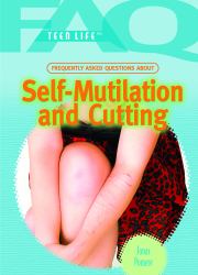 Frequently Asked Questions about Self-Mutilation and Cutting