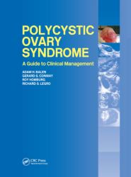 Polycystic Ovary Syndrome : A Guide to Clinical Management
