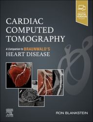 Cardiac Computed Tomography : A Companion to Braunwald's Heart Disease