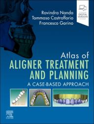 Atlas of Aligner Treatment and Planning : A Case-Based Approach
