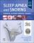 Sleep Apnea and Snoring : Surgical and Non-Surgical Therapy