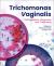 Trichomonas Vaginalis : Pathogenesis, Diagnosis, and Treatment