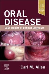 Oral Disease: Case Studies of Difficult Diagnoses : Case Studies of Difficult Diagnoses