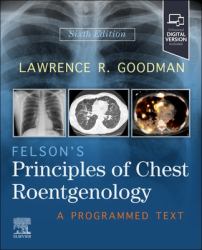 Felson's Principles of Chest Roentgenology : A Programmed Text