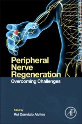 Peripheral Nerve Regeneration : Overcoming Challenges