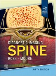 Diagnostic Imaging: Spine