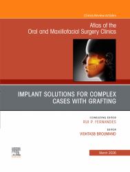 Implant Solutions for Complex Cases with Grafting, an Issue of Atlas of the Oral and Maxillofacial Surgery Clinics