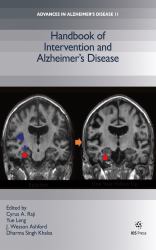 Handbook of Intervention and Alzheimer's Disease