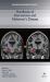 Handbook of Intervention and Alzheimer's Disease