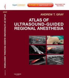 Atlas of Ultrasound-Guided Regional Anesthesia