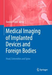 Medical Imaging of Implanted Devices and Foreign Bodies : Head, Extremities and Spine