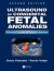 Ultrasound of Congenital Fetal Anomalies
